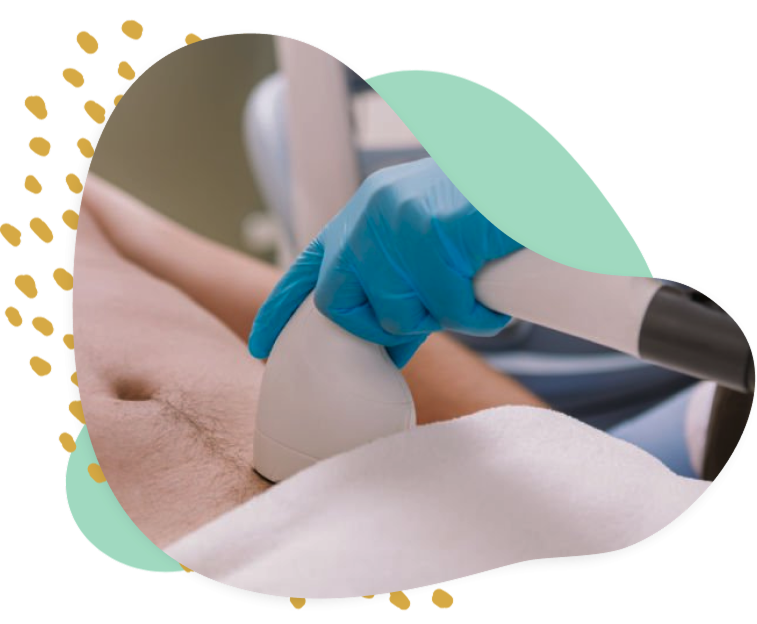 Laser Hair Removal for Men's Intimate Area in Prague obrázek 16