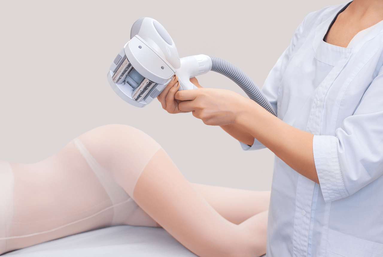 Fotoepilation vs. Laser-Epilation: Welche Methode entfernt Haare besser? obrázek 1