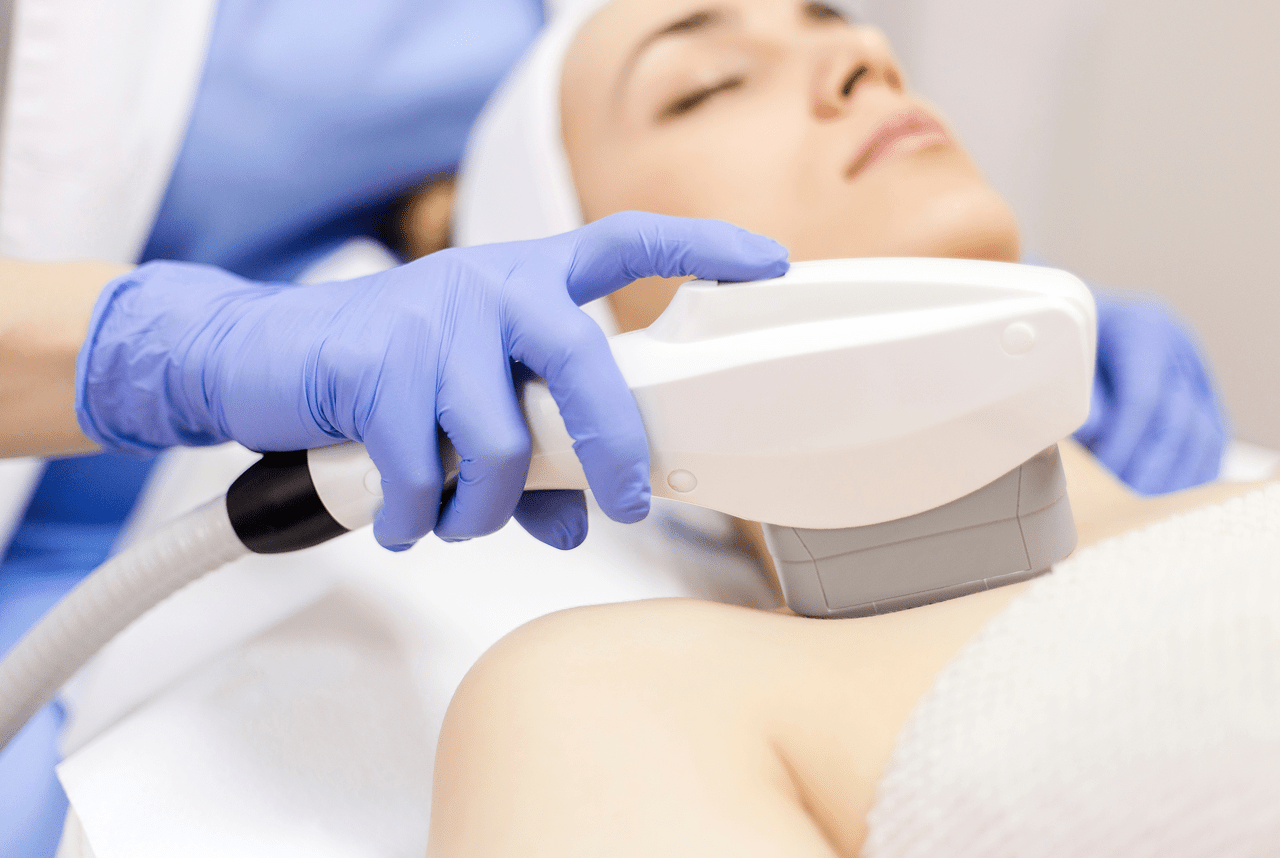 Fotoepilation vs. Laser-Epilation: Welche Methode entfernt Haare besser? obrázek 7